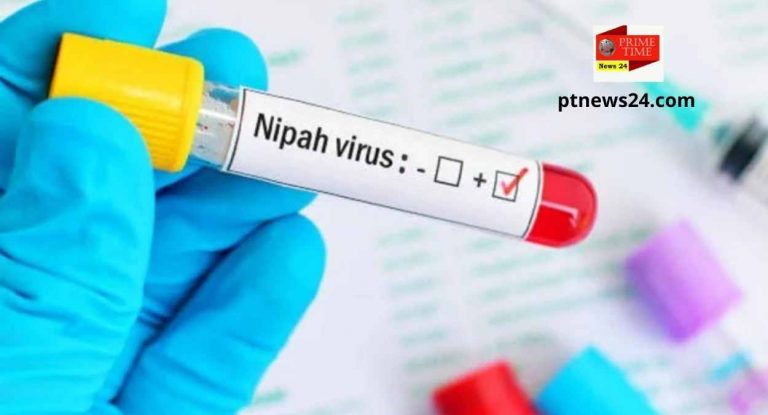 Nipah Virus Test Kit