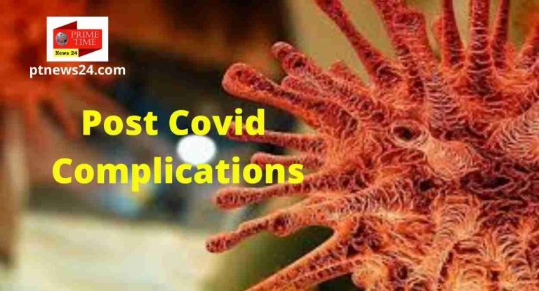 Post Covid Complications